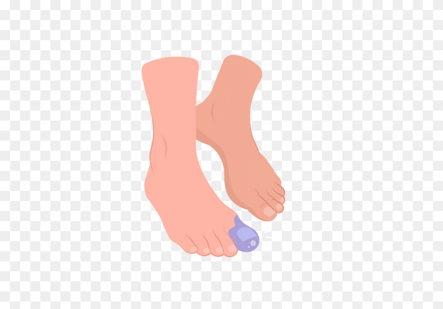Bruise Blue Snelm - Wiki Clipart - 