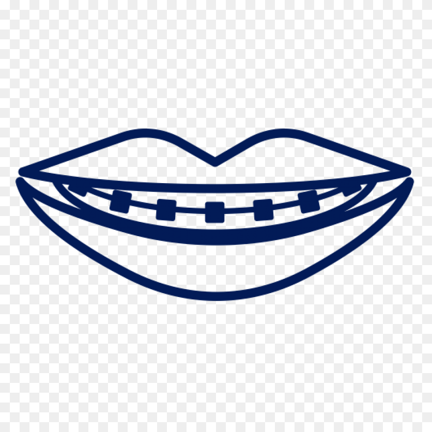 How Do Braces Work? - Peterson Fami