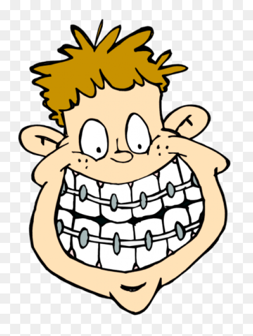 How Do Braces Work? - Peterson Fami
