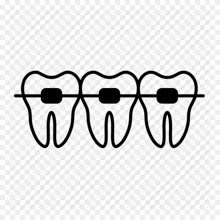 How Do Braces Work? Peterson - Braces