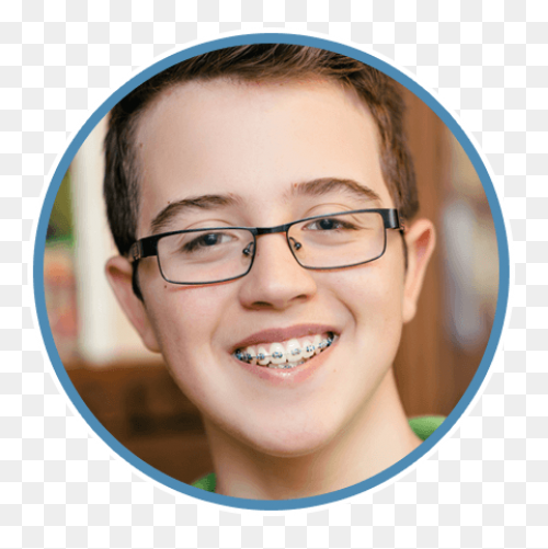 How Do Braces Work? - Peterson Fami