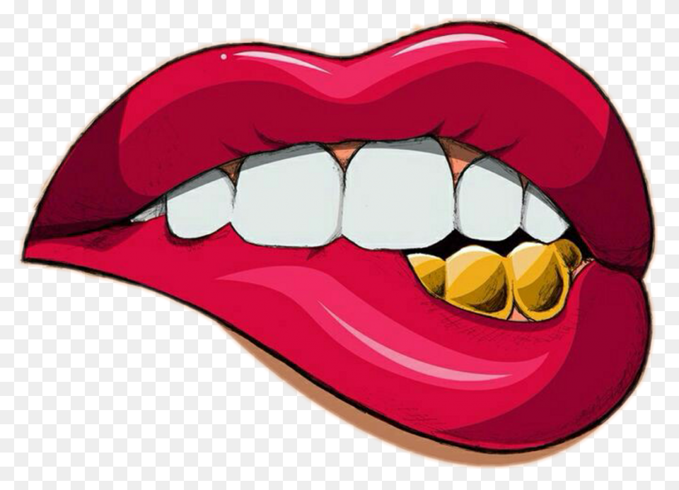 How Do Braces Work? - Peterson Fami