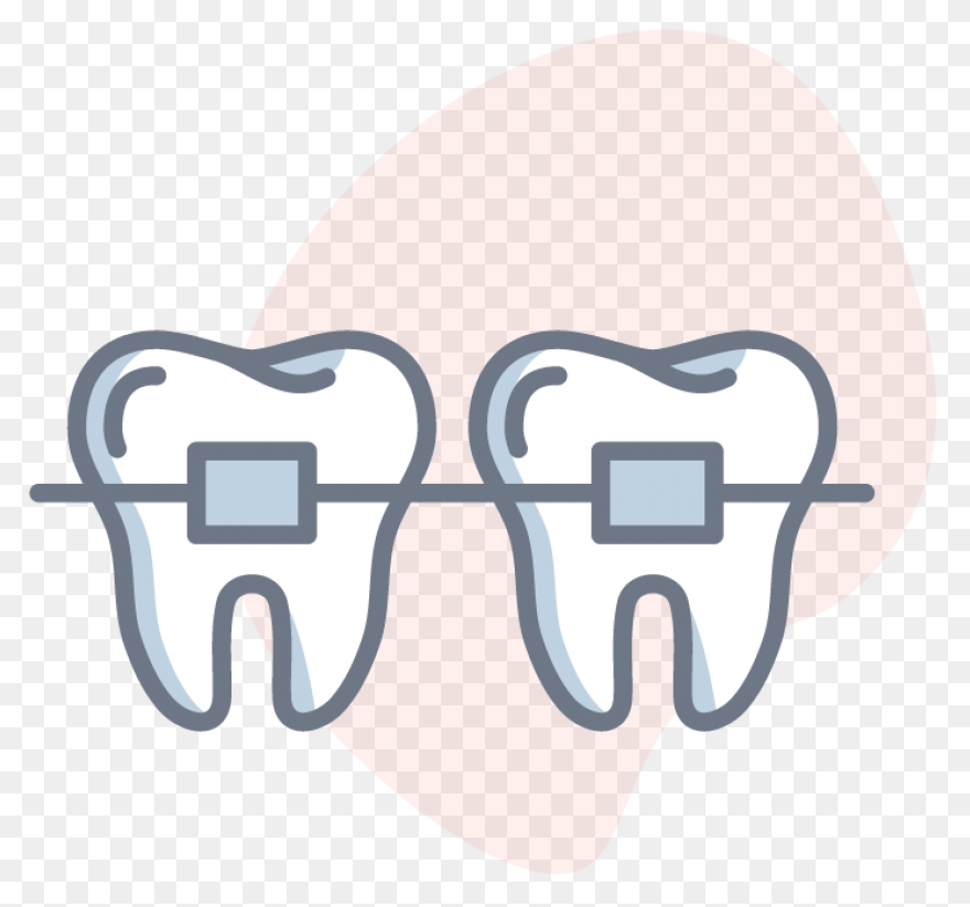How Do Braces Work? - Peterson Fami