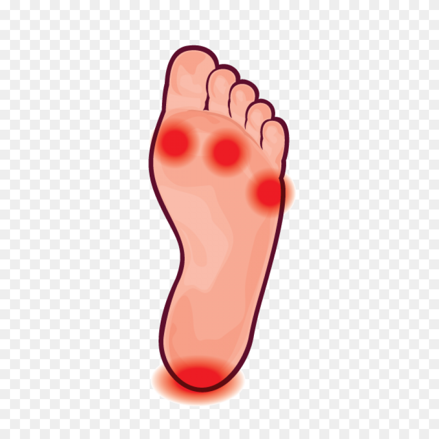 Hard Lump On Foot Causes | How To E