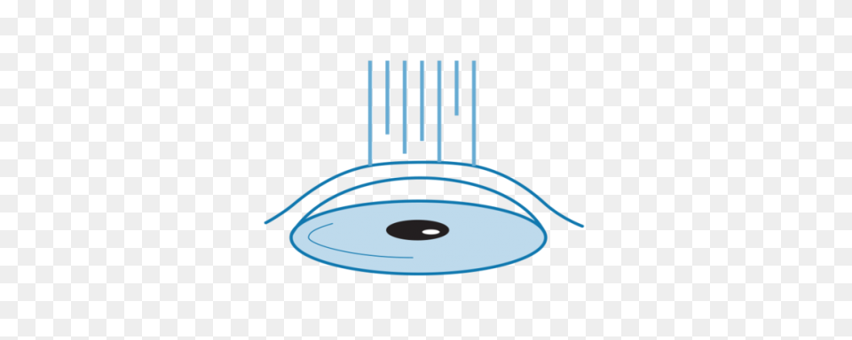 Photo Refractive Keratectomy (Prk) Or - Laser Eyes