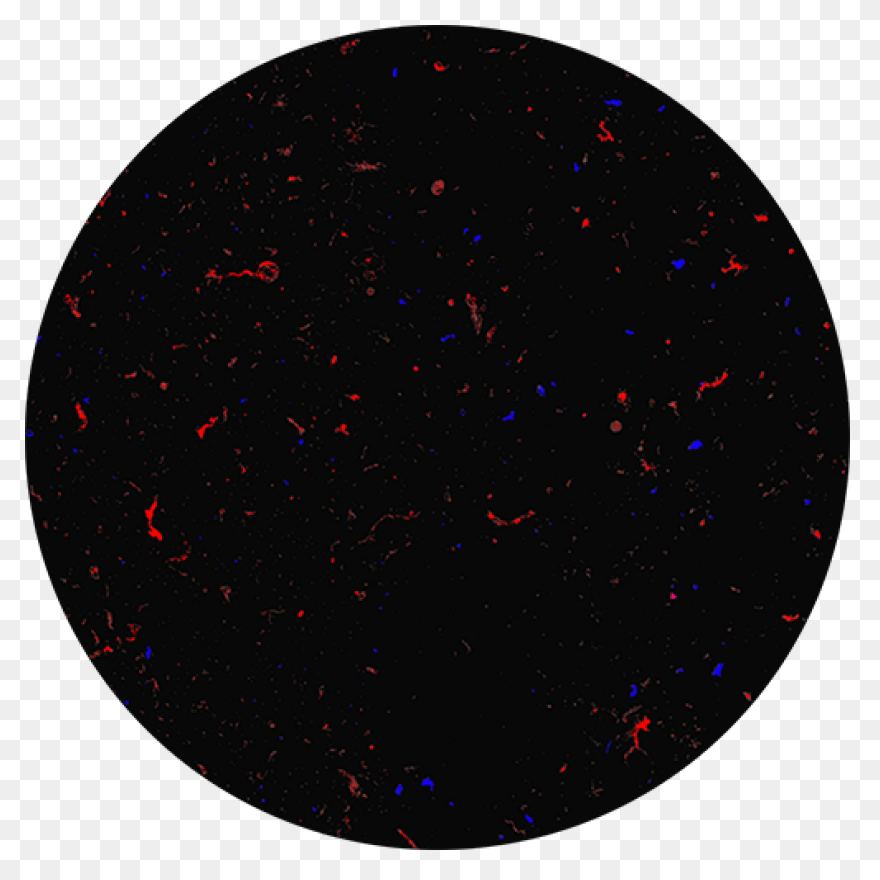 Aura Subvisible Particle Analysis Instrument - Light Particles