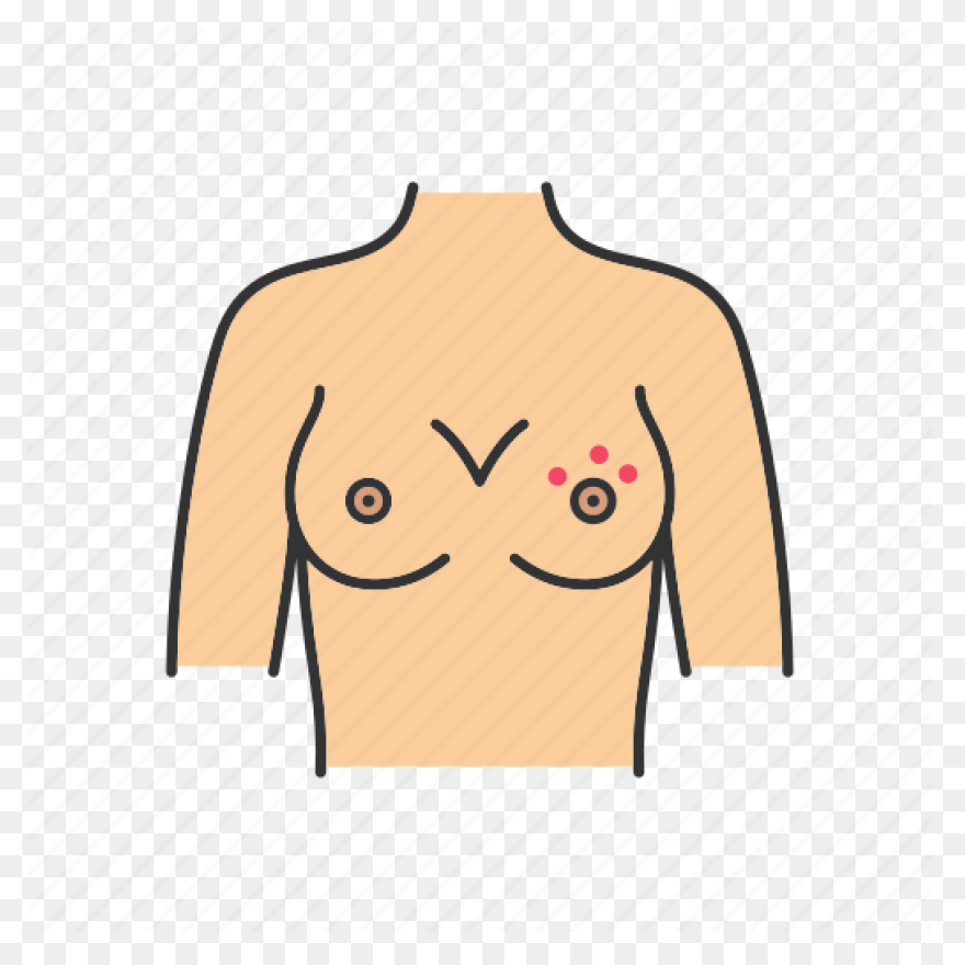 Cracked Nipple In Arasaac · Global