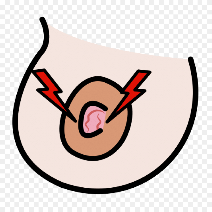 Cracked Nipple In Arasaac · - Nipple