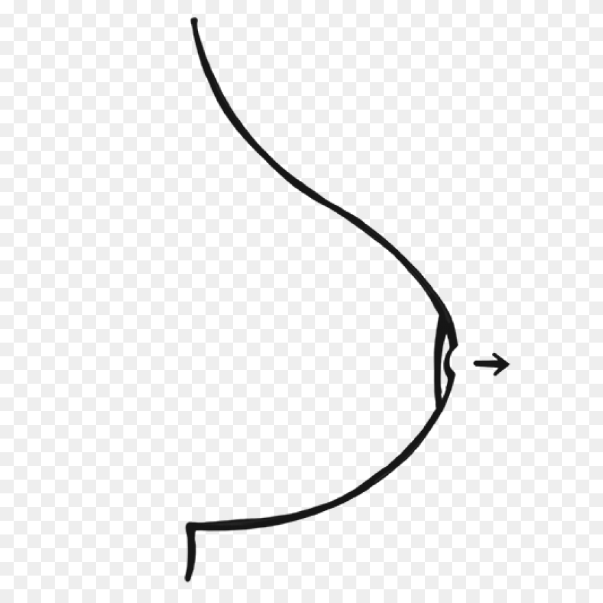 Cracked Nipple In Arasaac · Global