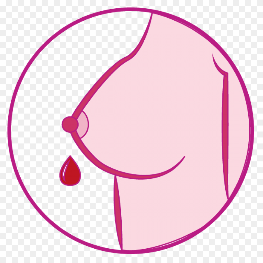Cracked Nipple In Arasaac · Global