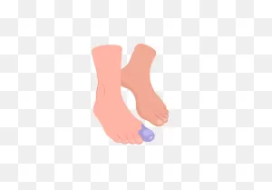 Injuries That Cause Bruised Toe Or Foot | Buoy