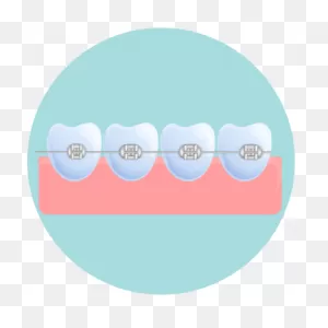 Comfort Care For Braces | Saxe Orthodontics