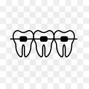 How Do Braces Work? - Peterson Family Orthodontics