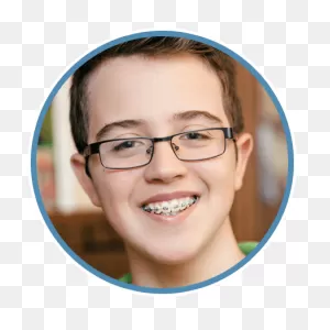Orthodontics | Braces In San Antonio, Tx | ClipartFlare