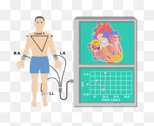 The Electrocardiogram (Ekg Or Ecg)