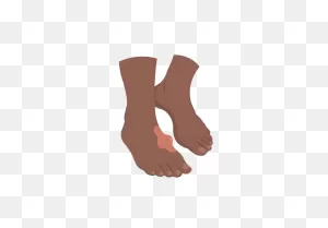 Hard Lump On Foot Causes | How To Eliminate A Hard Foot Lump