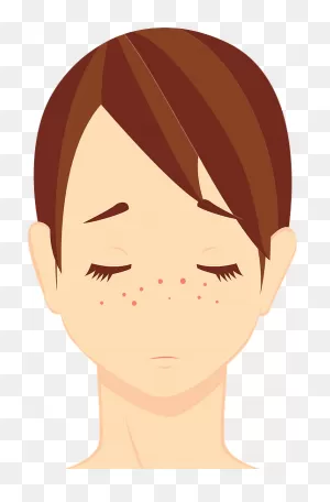 Skin Care For Freckles Clipart. Free Download Transparent .png ClipartFlare.com 