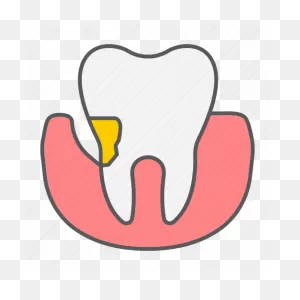 Tooth, Periodontitis, Stomatology, Disease, Plaque, Dental ClipartFlare.com 
