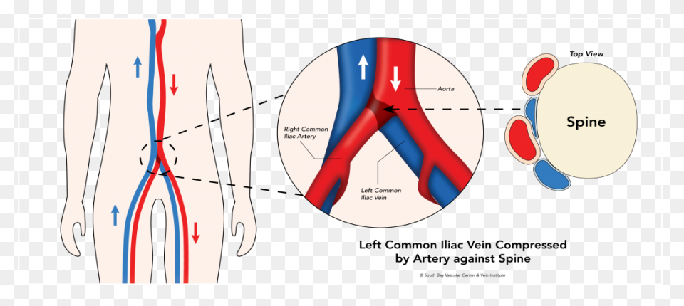 Coronary Veins | Cardiac Veins
